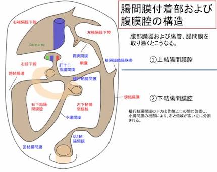 右半結腸切除、回盲部切除