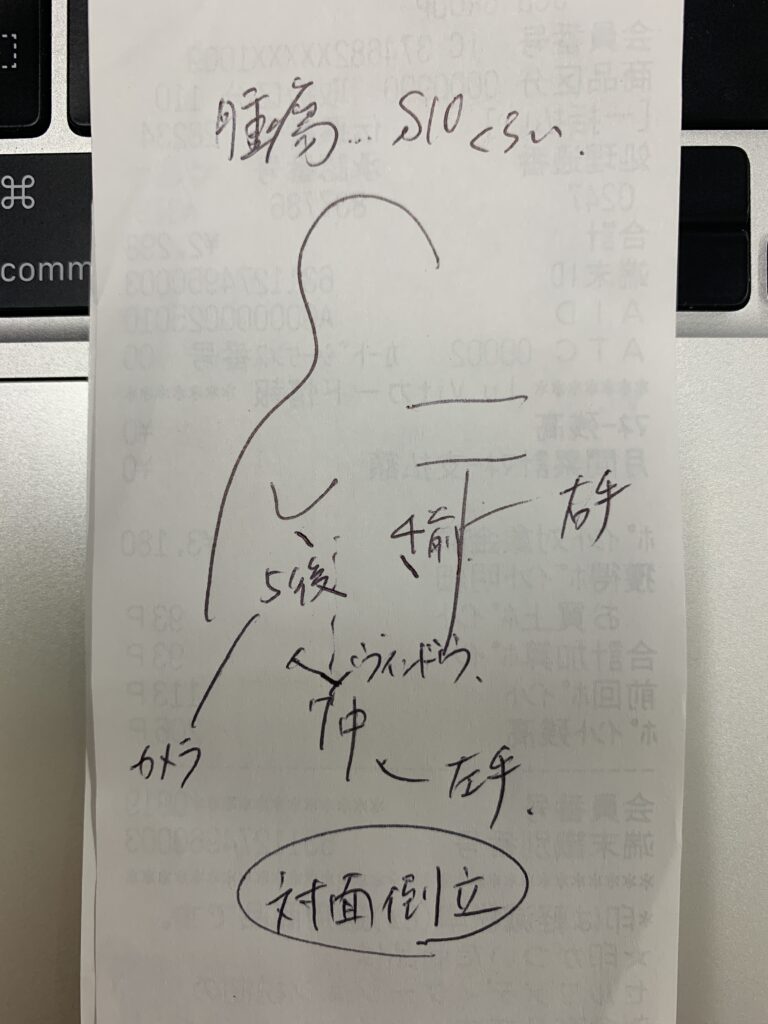 部分切除。対面倒立でやらざるを得ないこともある。