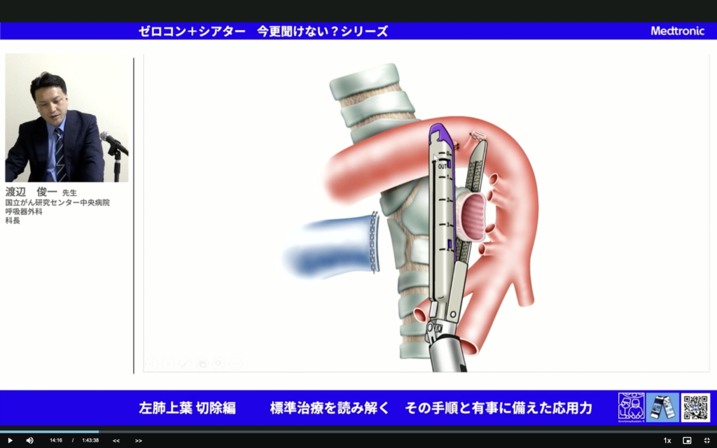 【見て覚える解剖】【左上葉切除】覚える価値のある絵、気管支先行処理は解剖の勉強になる。必須。