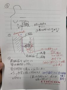 3/3開胸部分切除