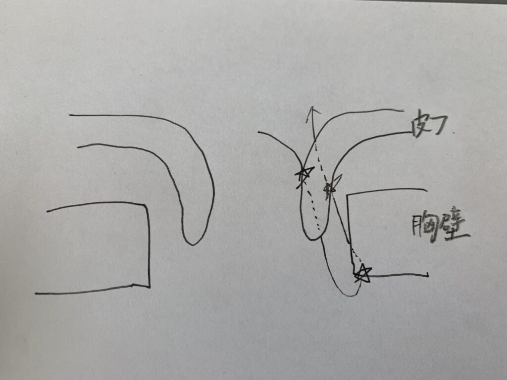 開窓の型（かいそうのかた）