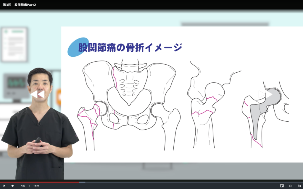 整形外科も学ぼう①腰痛、股関節痛
