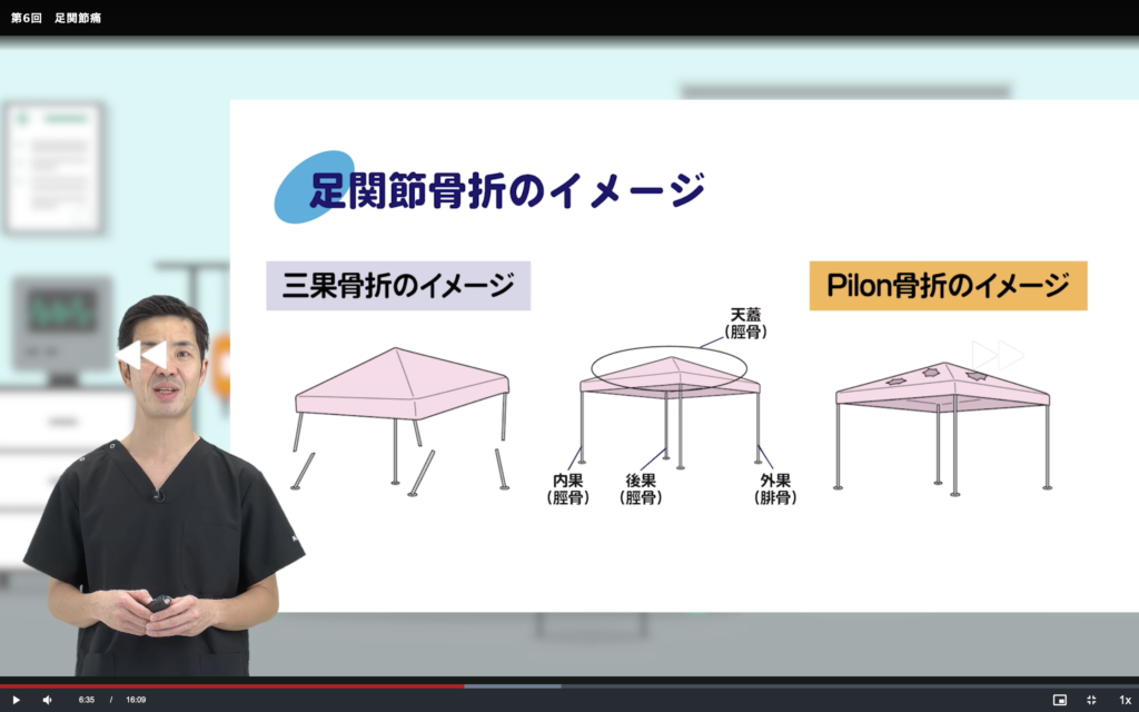 整形外科も学ぼう③足関節痛