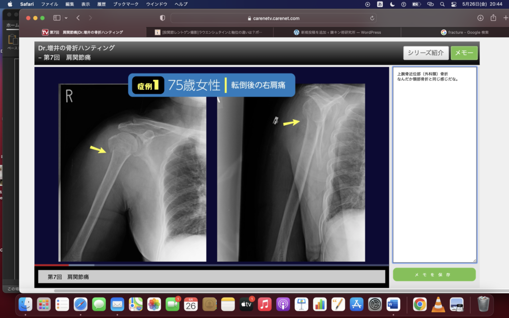 整形外科も学ぼう④肩関節痛（脱臼とかもあってちょっと毛色違う！）