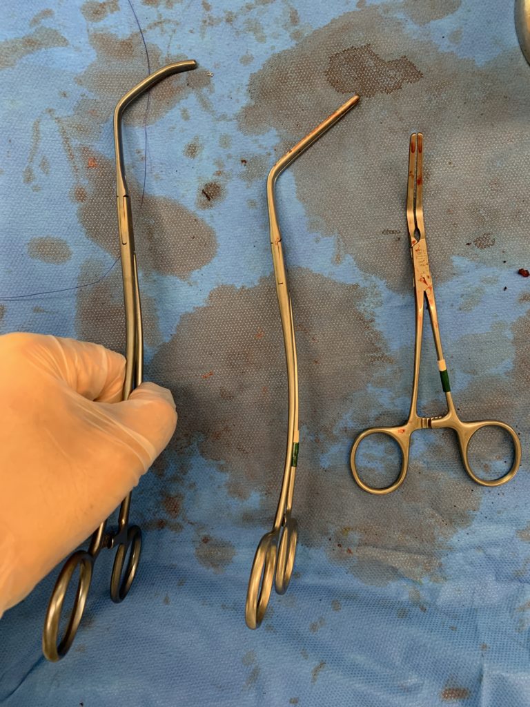 出血時の対応；心嚢内血管確保含めて