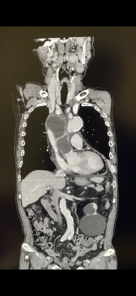 KNTN病院から大学に送ったこの人は