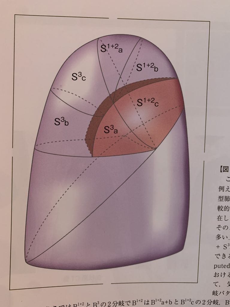 左S1+2区域切除＝YN流手術の要諦