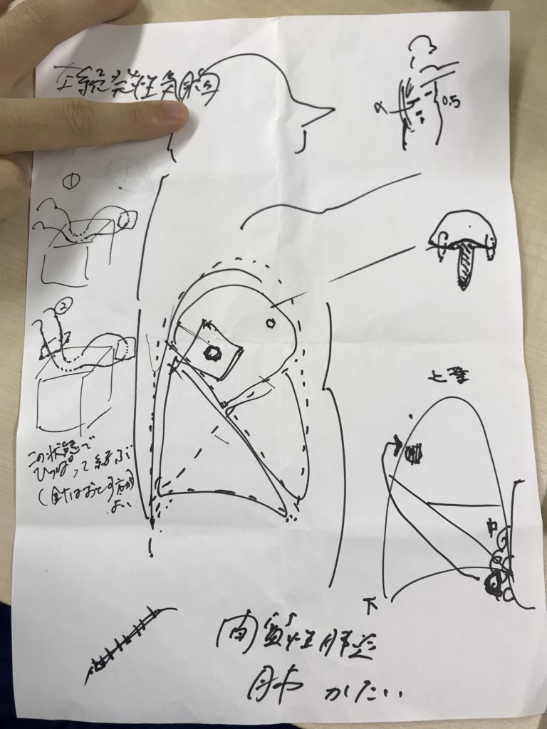 昨日の肺瘻閉鎖術。感動した