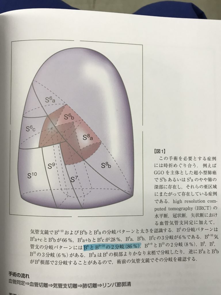 右下葉の区域解剖について