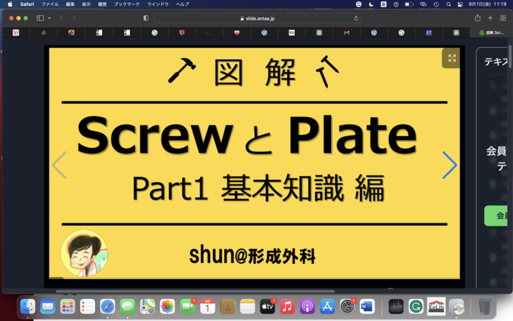 肋骨骨折に対する観血的整復固定術をはじめて行った＝スクリューとプレートに関する基礎知識も身についた