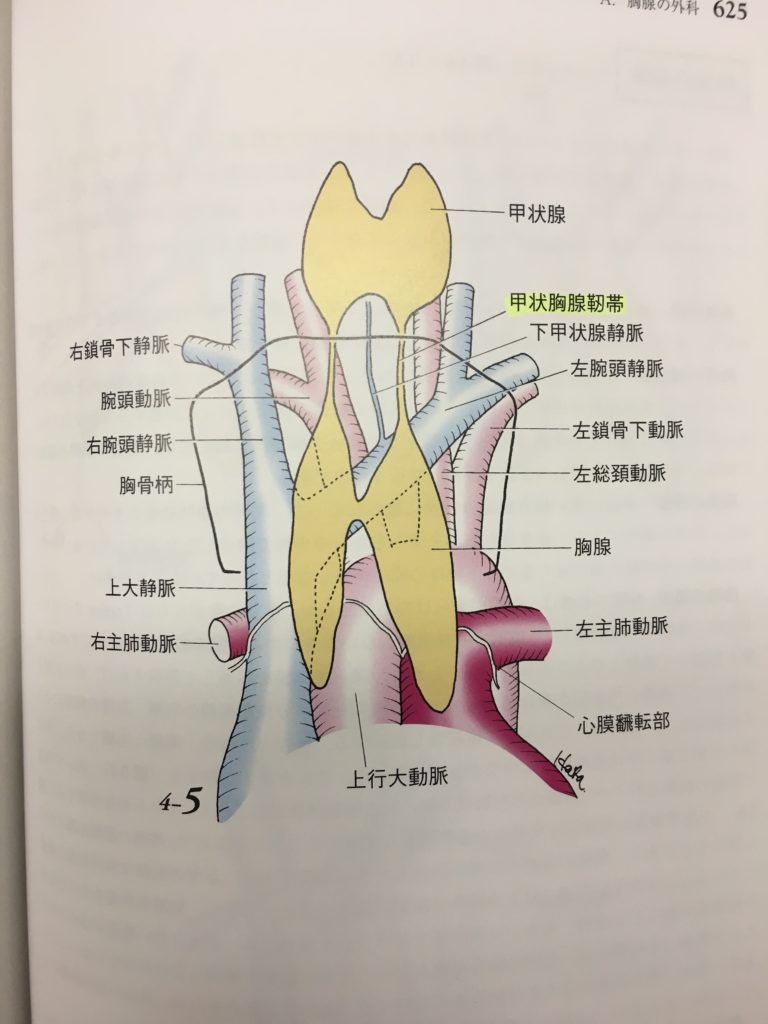 胸腺腫について。そして胸の上のほうの血管の解剖＝TNM、正岡、治療や予後に関しても＝半分悪性腫瘍、半分自己免疫疾患の不思議な病気