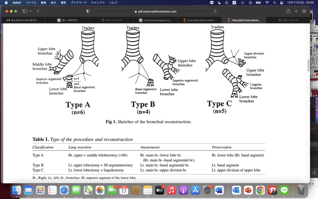 extended sleeveとは＝あきらめないことが大事！