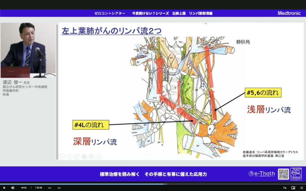 舌区のリンパ流について＝上にいかず#11にいく（2024/1/30追記：自分として、まだはっきりとはわかってない！）＝外科医も外来やるべき理由