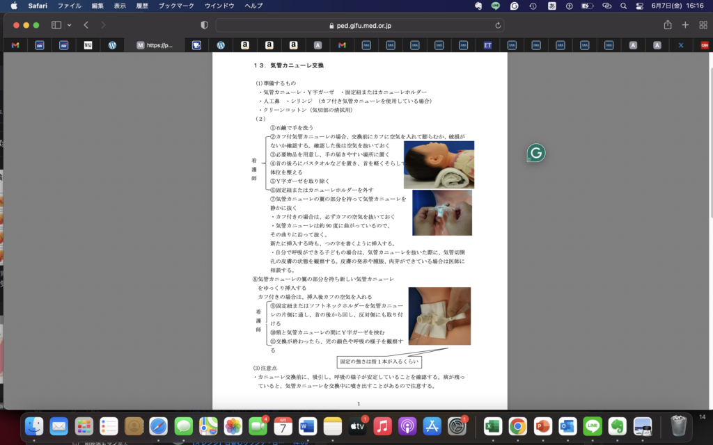 呼吸器外科アップデート２週間分＝さかのぼって思い出す