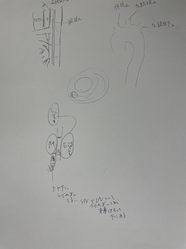 なんでこんなことも知らなかったんだろう。右縦隔の解剖詳細にわからないと緊急時に対応できん