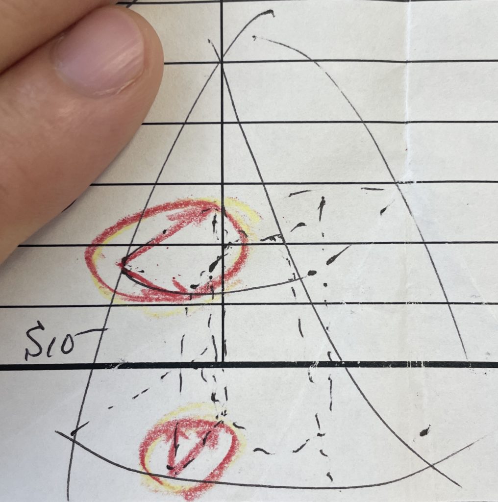 呼吸器外科アップデート